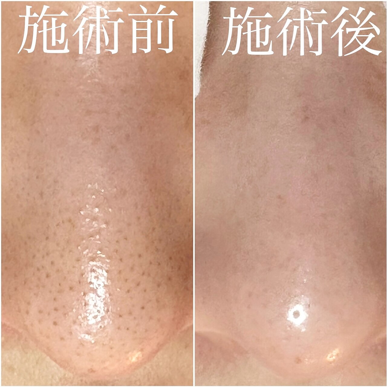 毛穴塾｜ホットペッパービューティー