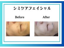 リヴェーヌ 富山店/しみ改善もお任せください