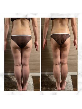 エムズ ビューティー サロン(M's Beauty Salon)/ビフォーアフター