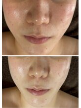 マリエンドリー/