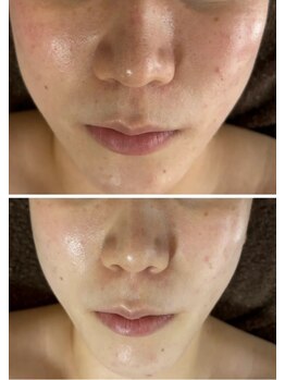 マリエンドリー/