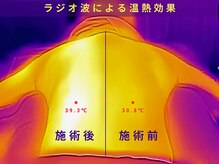 プラチナムアロマ 名古屋栄店(PLATINUM AROMA)/ラジオ波の後にリンパマッサージ