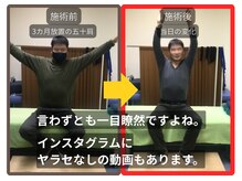 まこと整骨院/ずっと取れない長引く肩の痛み１