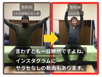 まこと整骨院/ずっと取れない長引く肩の痛み１