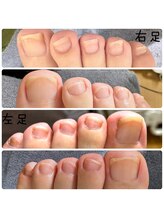アルシエロ(al cielo)/足ネイルケア