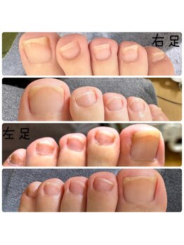 アルシエロ(al cielo)/足ネイルケア