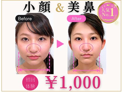 ラプリ 梅田店(Raplit)の写真