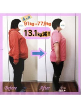 アミージュ(amige)/ビフォーアフター