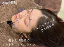 宮町鍼灸整骨院
