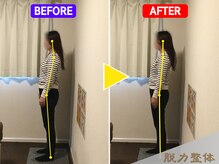 幸せのもり整体院/30代女性/Nさん