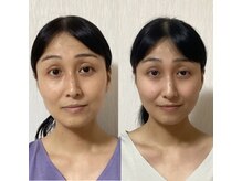 リベルテエイト(Liberte8..)/