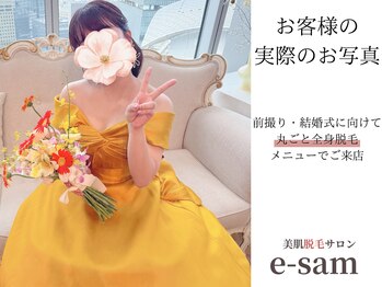 イーサム(e-sam)/丸ごと全身脱毛