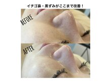 プレジール(Plaisir)の雰囲気（毛穴ケアもお任せ下さい。イチゴ鼻/黒ずみ/ツヤ肌/フェイシャル）