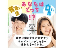 これからの季節に白い歯で笑顔に自信を♪顧客満足度NO.1　★