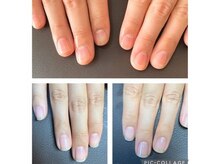ナチュアネイル(Natur Nail)/ネイルケアコース