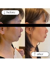 トータルビューティーサロンリア(Li'a)/ビフォー＆アフター