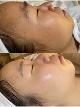 ユミサロン(U Mi Salon)/くすみにさようなら、透明肌へ。