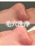 一度体験したら通いたくなる！毛穴洗浄