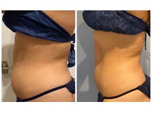 ルナグランデ 心斎橋店(Luna grande.)/お腹も引き締め