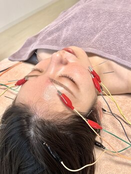 笑美福の写真/電気を流す美容鍼で表情筋にアプローチ！オーダーメイドであなたに必要な一本を選びます。