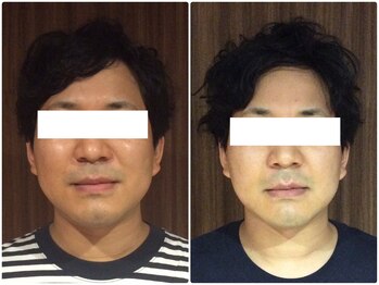 美容整体 ウェリナ 蟹江院/小顔矯正/骨盤矯正/美脚サロン