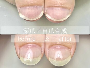 ル リアン 北浦和(le lien)/深爪育成(4ヶ月／6回)