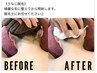 【夏に向けて！】うなじ脱毛　2,200円