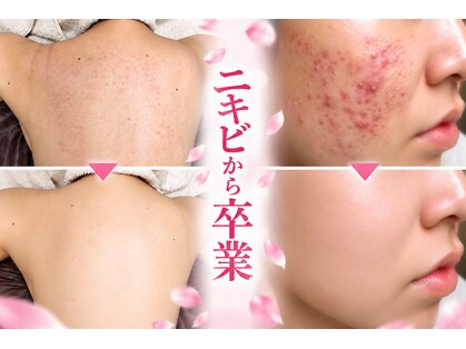 スリリアン 銀座の写真