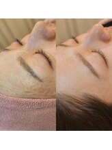 レイネイル レイエステティック 岐阜茜部店(RAY NAIL & RAY ESTHETIC)/ゾンビマスク