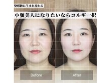 オプレア 千種店(OPREA)