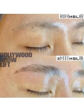 アロー(Allo!)/HBL ハリウッドブロウリフト