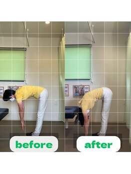 ナオル整体 長崎大村院(NAORU整体)/60代女性施術事例【骨盤矯正】