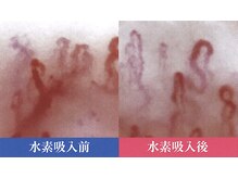 雅 平塚(みやび)/水素取り込んだ後の血液の流れ