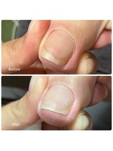 アルシエロ(al cielo)/フットネイルケア