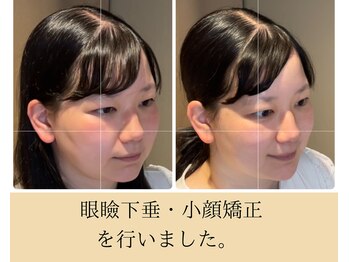 エール(EALL)/【頭蓋骨矯正2】