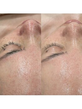 レボン(rebon)/【ボンバー】ビフォーアフター