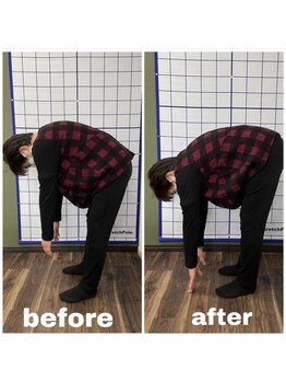 むげん整骨院/動きの変化