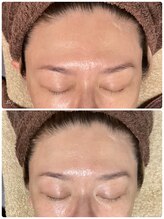 シャナ(Shana)/ラミネーションピール