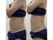 ブリリアント(Brilliant)/【痩身】40代