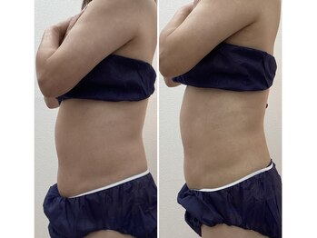 ブリリアント(Brilliant)/【痩身】40代