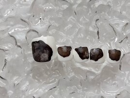 《foot》定額デザイン