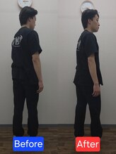 最後の整体 練馬駅前院/腰痛でお悩みの方の可動域
