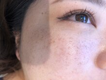 ベリー 中田店(Very)/【静岡　マツエク】