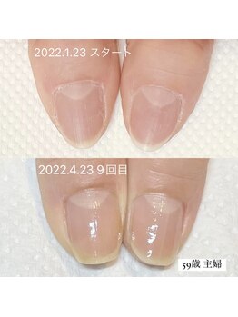 ホワイトネイル 武蔵小杉店(WHITE NAIL)/【自爪育成】