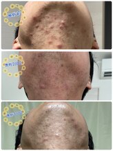 ルリアン(Le lien)/before after