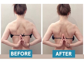 ユヴィラ(YUVIRA)/肩甲骨はがしで背中美人！