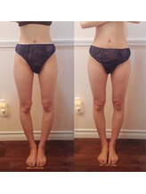 ロックスペーストーキョー(Rock Space Tokyo)/インディバ整体/九段下／銀座