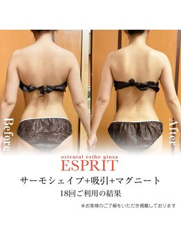 エスプリ 新宿店/背中キレイ天使の羽・ダイエット