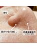 【毛穴特化】開き/詰まり/目立ちなど、あなた毛穴悩みに合った施術をチョイス
