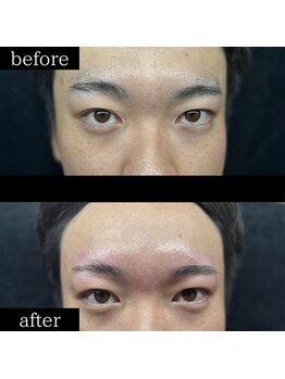 ユー 千葉駅前店(you)/メンズ眉毛/メンズ眉